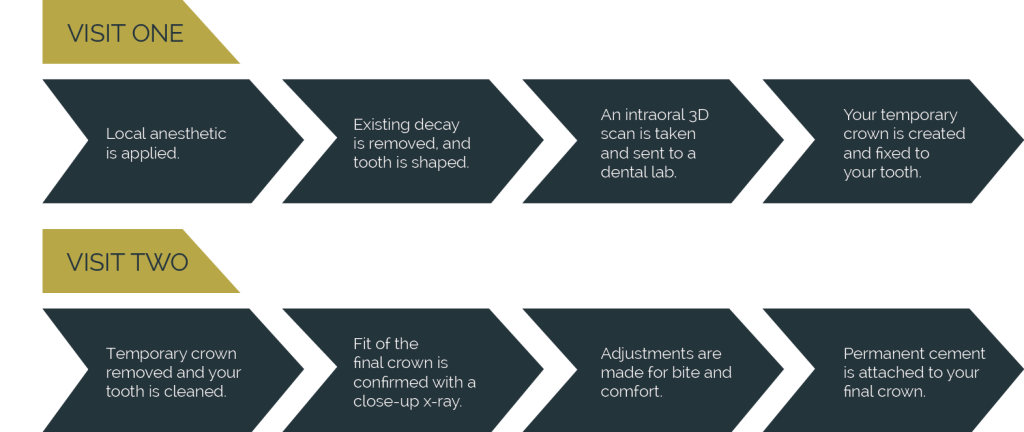 Image showing the process of getting a dental crown in two visits